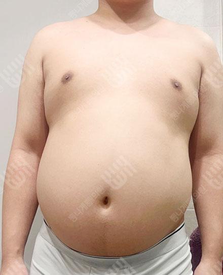 男性腹部5 전
