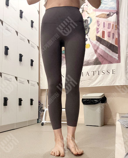 大腿吸脂 후
