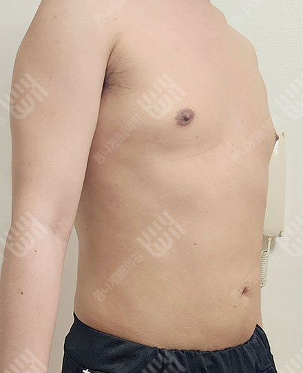 男性腹部3 후