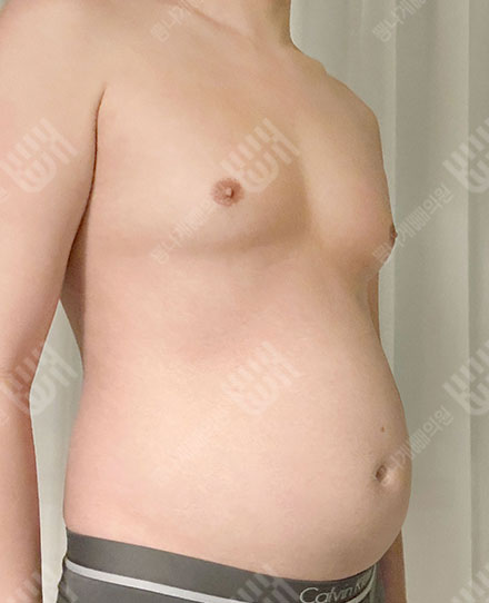 男性 腹部 전