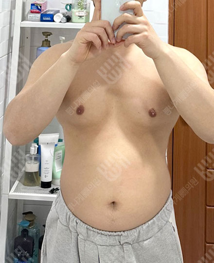 男性腹部2- 전