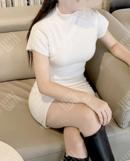 手臂吸脂9 후