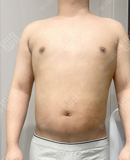 男性腹部5 후