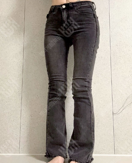 大腿吸脂2 후