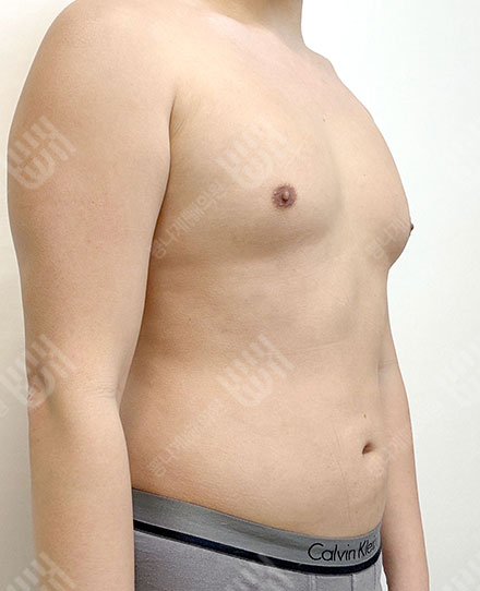 男性 腹部 후