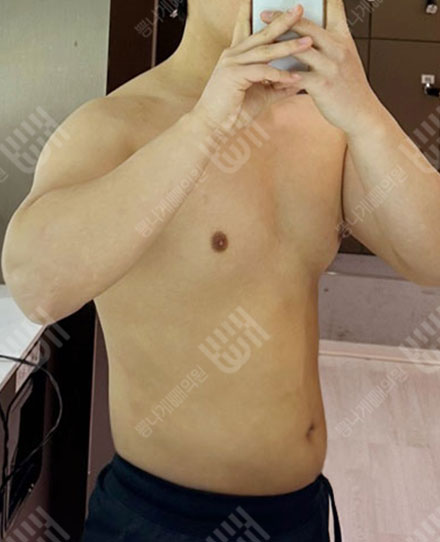 男性腹部4 후