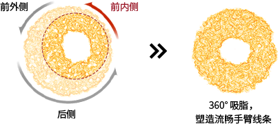 360° 吸脂，塑造流畅手臂线条