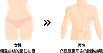 女性 侧重曲线的脂肪抽吸 >> 男性 凸显腹肌形态的脂肪抽吸
